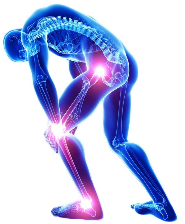 Резкая боль при движении - симптом заболевания суставов. 